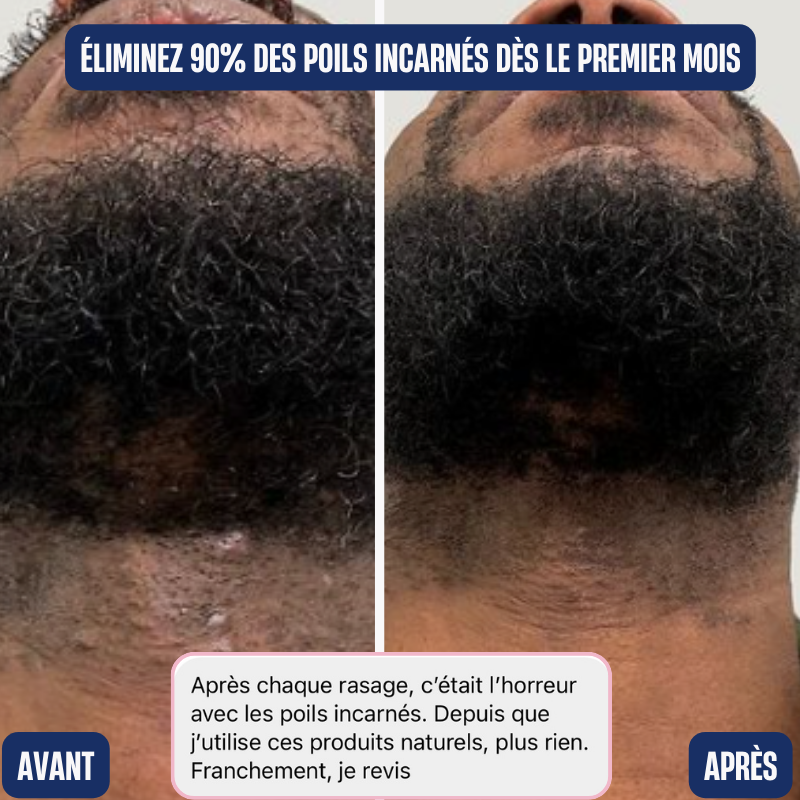 Gommage visage et barbe