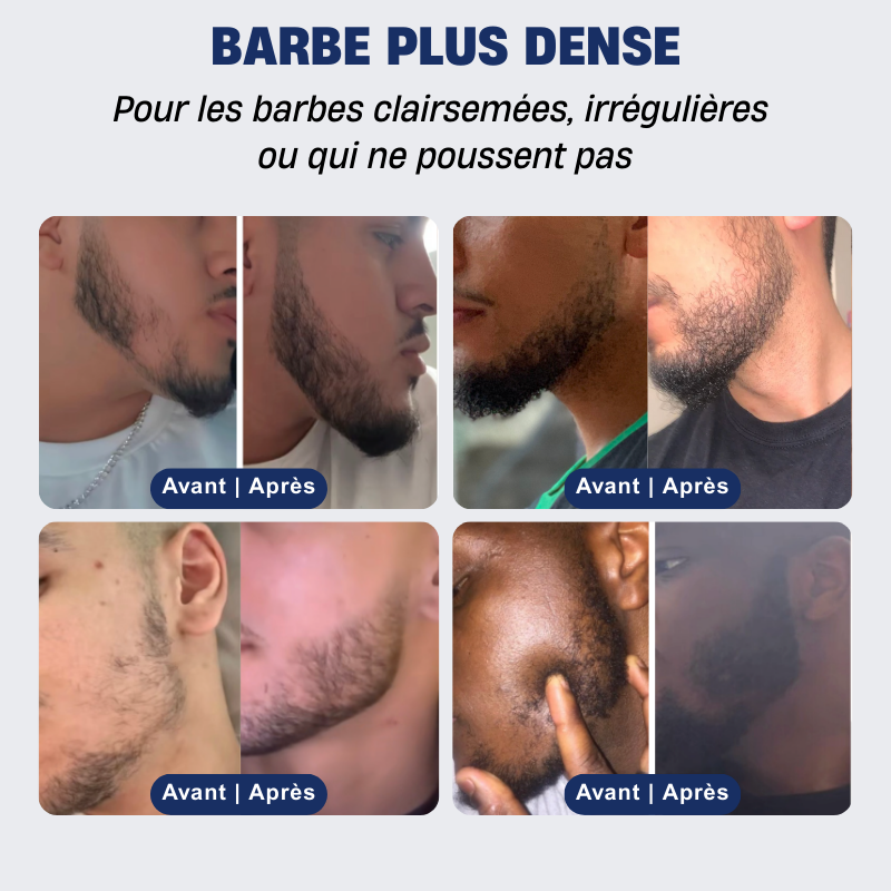 Pack Barbe Douce Complet