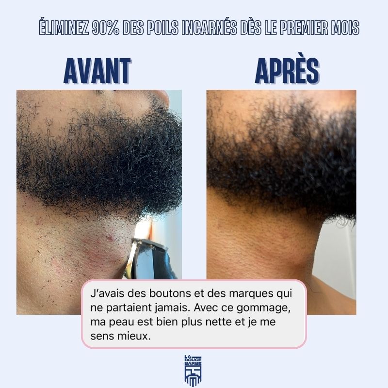 Brosse exfoliante barbe / cheveux