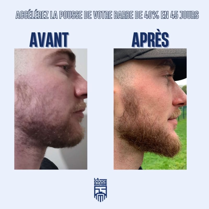 Shampoing à barbe