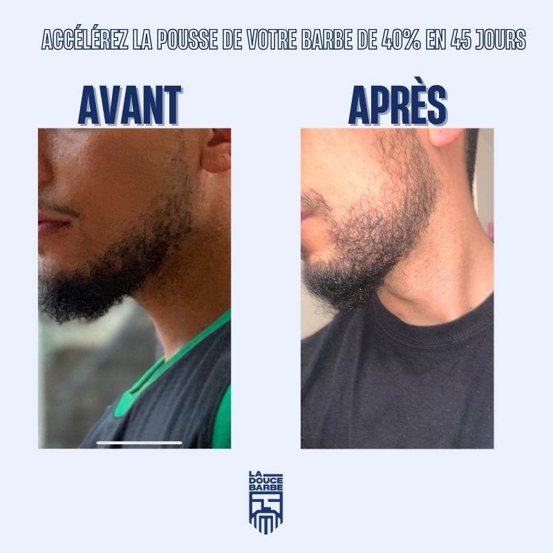 Huile à Barbe