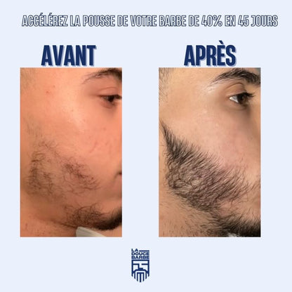 Huile à Barbe